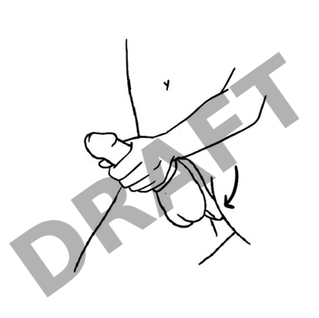 Вибростимулятор промежности с двойным кольцом Benedict